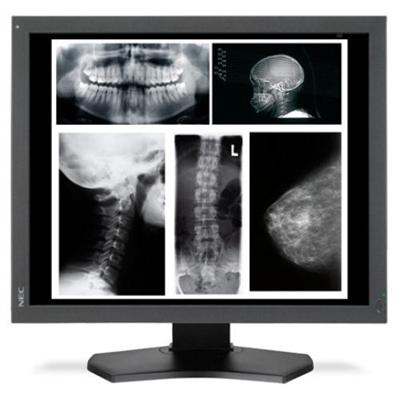 MultiSync MD215MG-S5 - LCD display - 5MP - grayscale - TFT - 21.3 - with Chroma5 calibration sensor